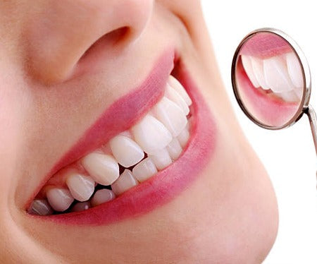 Teeth Whitening – Brighten Your Smile Naturally