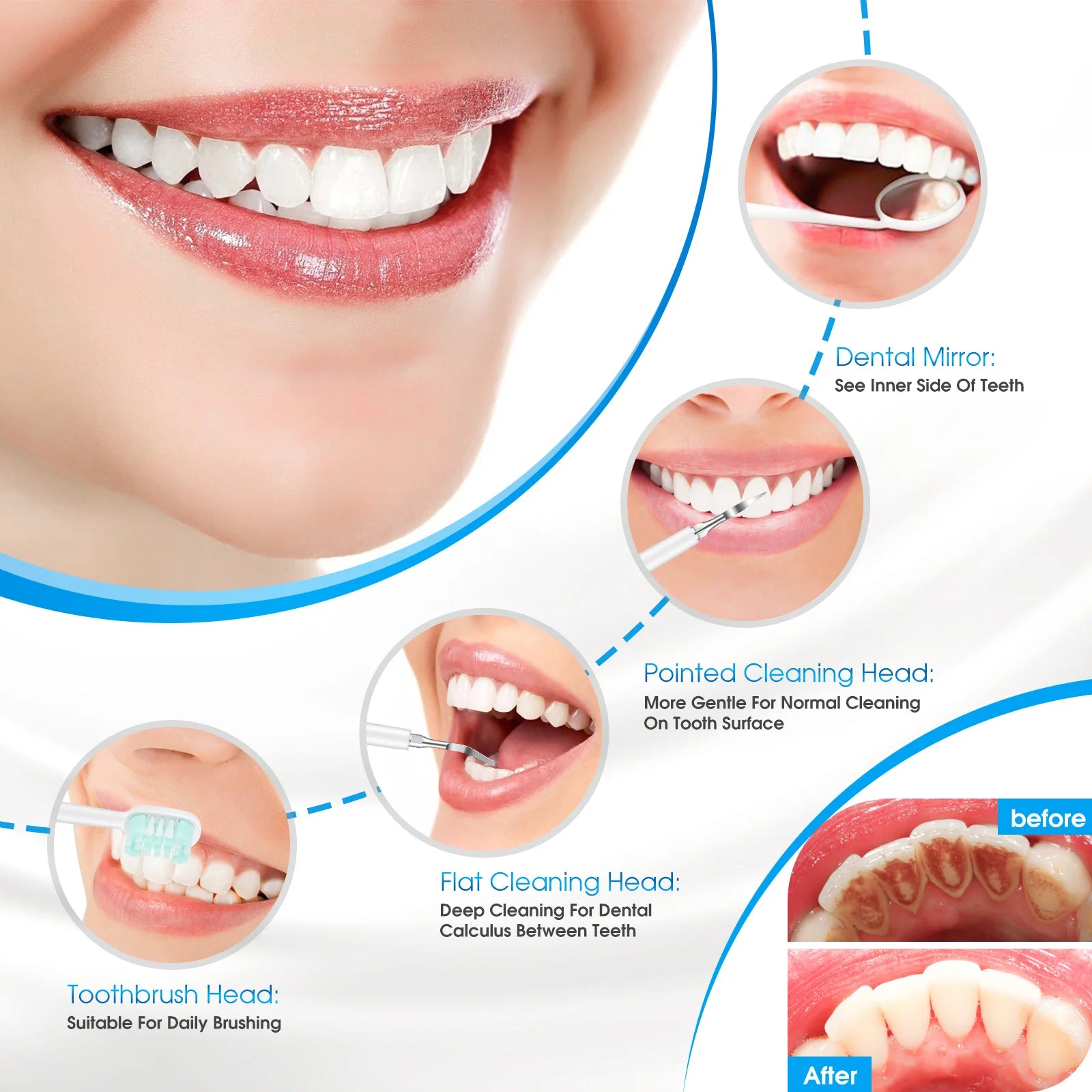 Sonic Teeth Whitening Kit