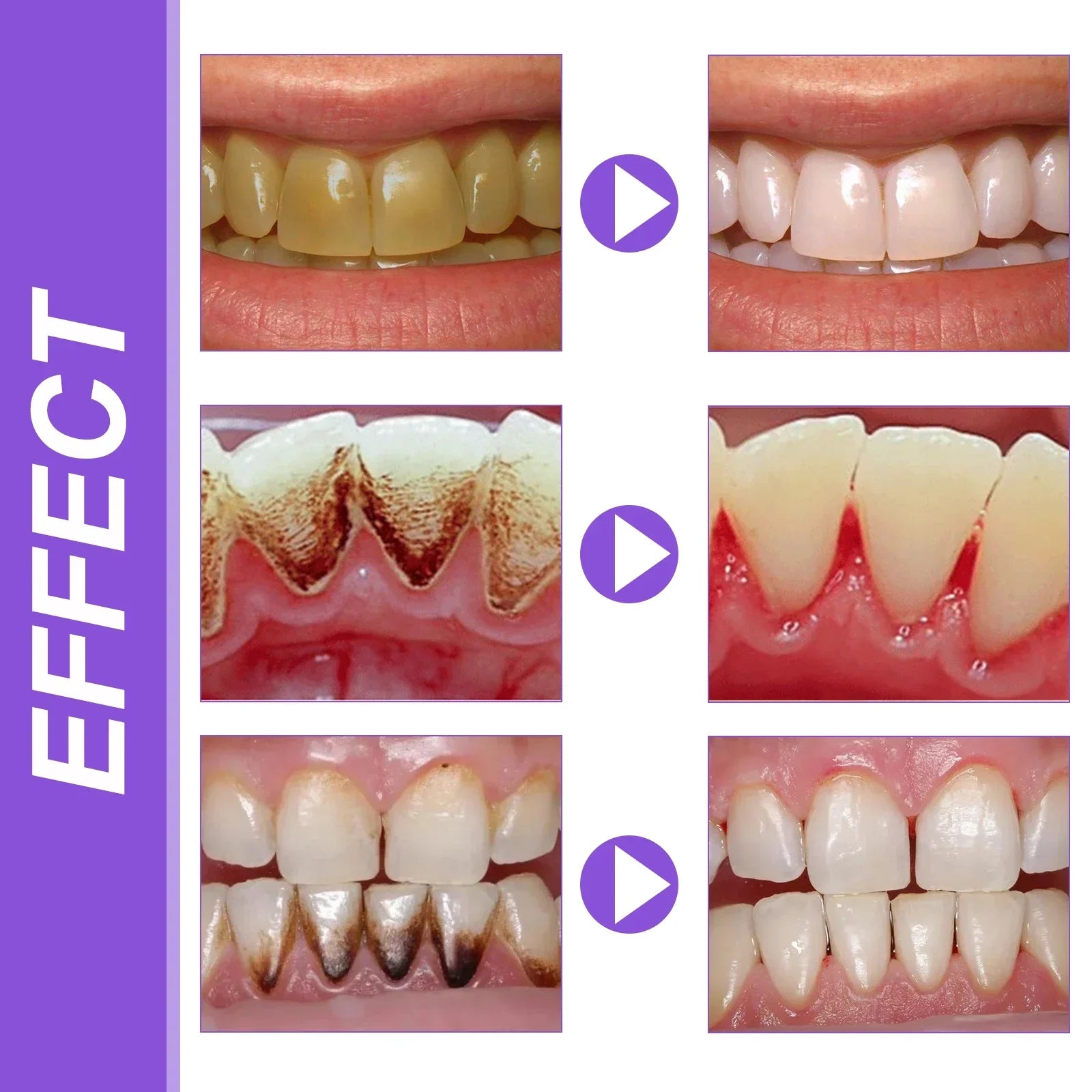 Purple Teeth Whitening Toothpaste