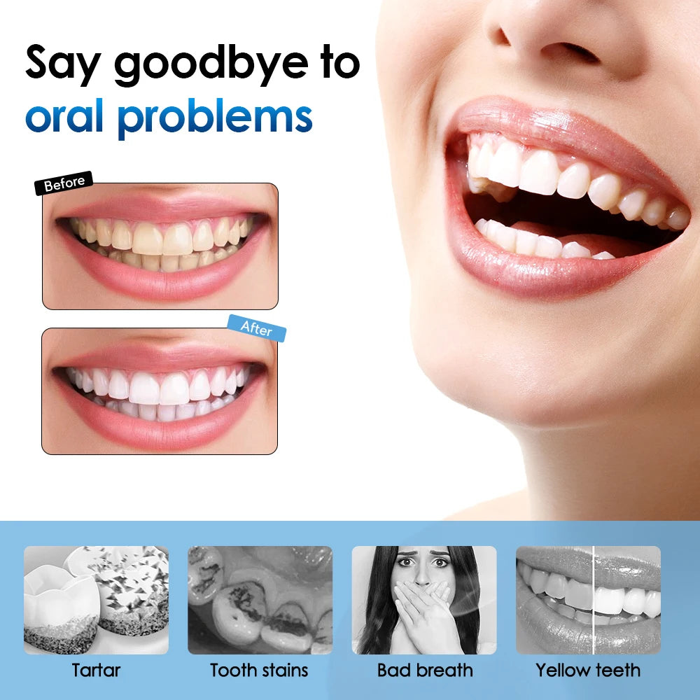 Electric Sonic Dental Scaler Toothbrush