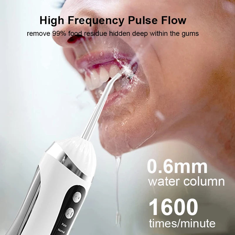 Oral Irrigator Water Flosser