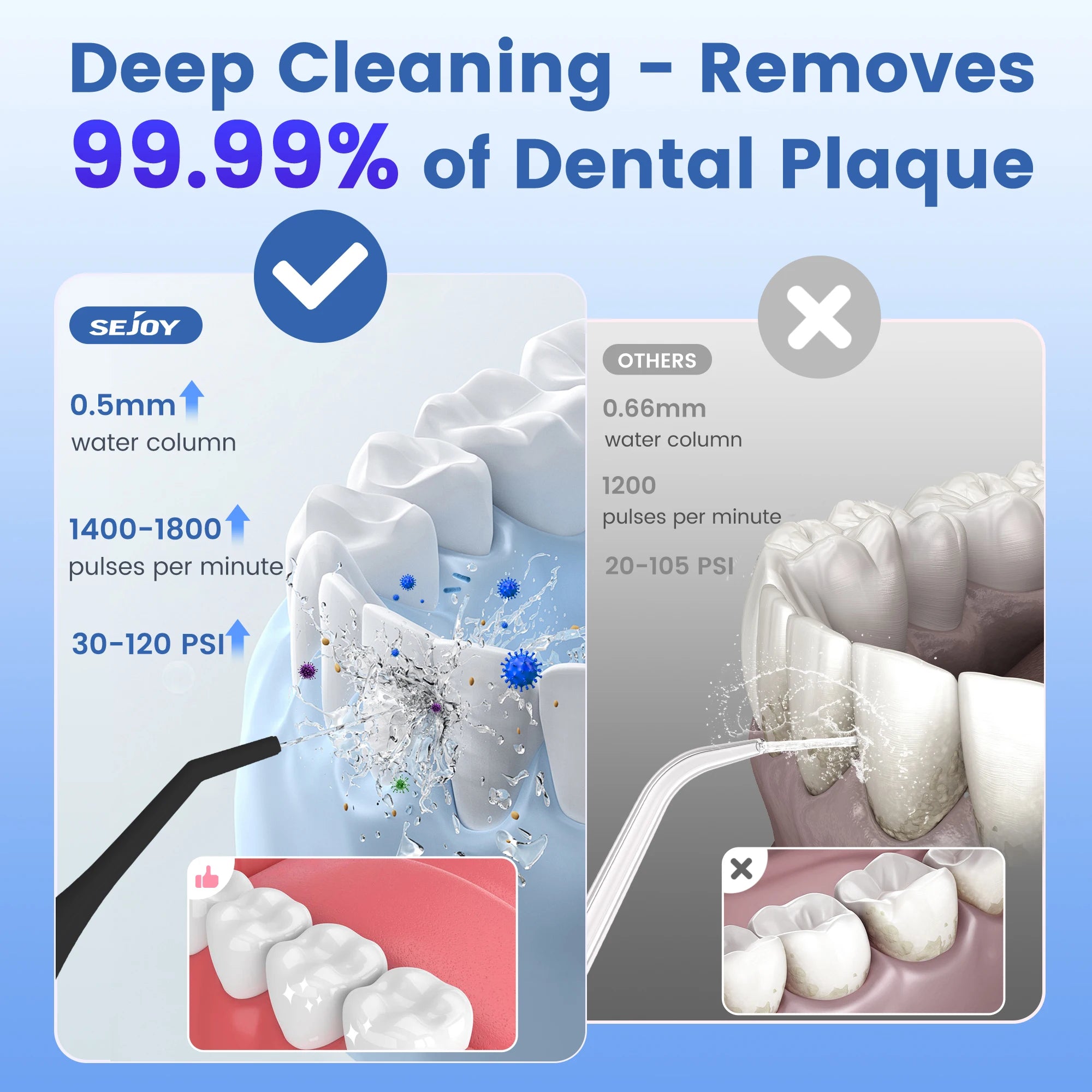 SEJOY Water Flosser